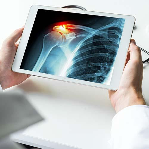 10 Things Anyone Suffering from Shoulder Pain Should Try before Going Under the Knife